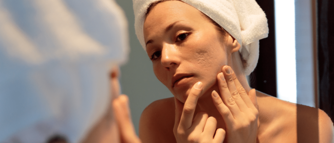 facial treatments