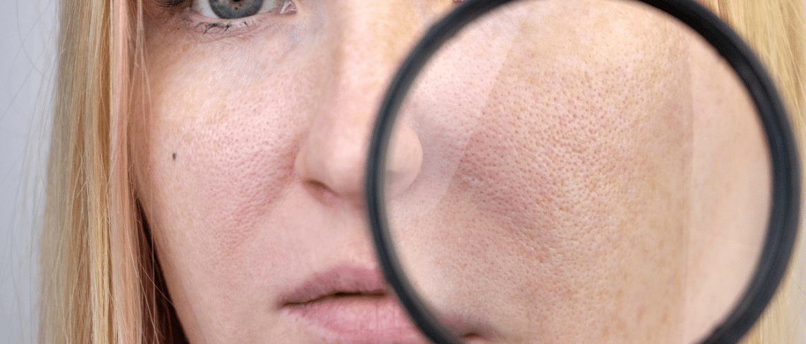 10 Effective Ways To Unclog Pores
