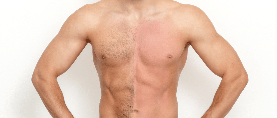 Facial waxing is a popular choice for men