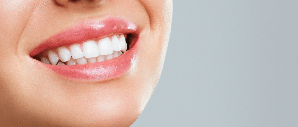 teeth whitening appointment