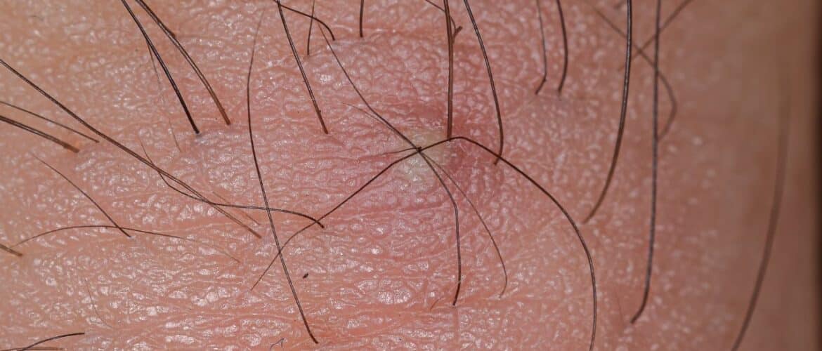 key aftercare tips