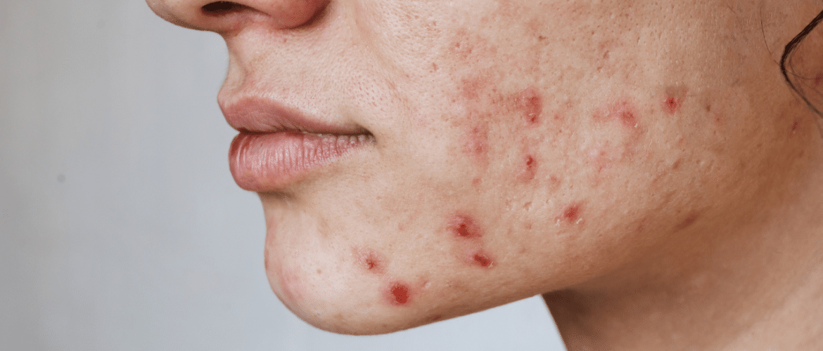 facial skin care Las Vegas