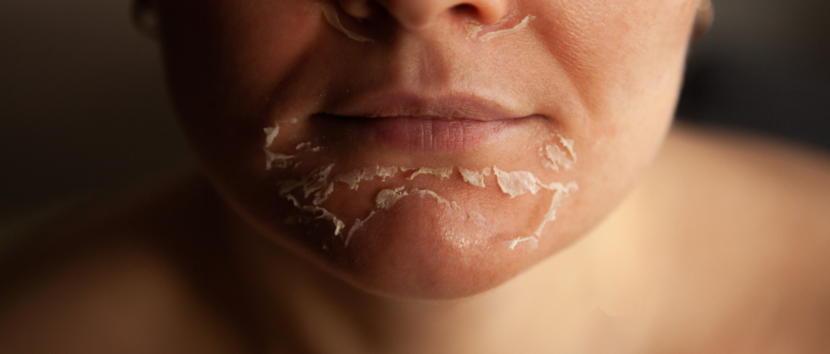 facial skin care Las Vegas