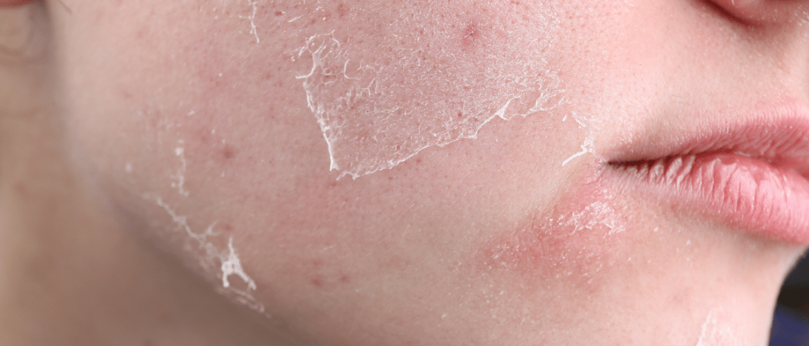 Las Vegas facial skin care